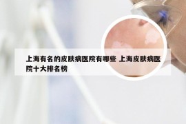 上海有名的皮肤病医院有哪些 上海皮肤病医院十大排名榜
