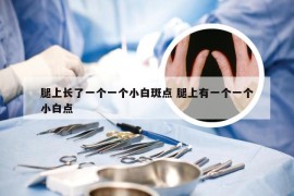腿上长了一个一个小白斑点 腿上有一个一个小白点