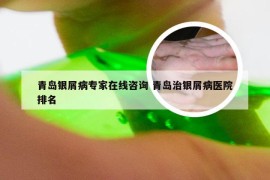 青岛银屑病专家在线咨询 青岛治银屑病医院排名