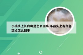 小孩头上长白斑是怎么回事 小孩头上有白色斑点怎么回事