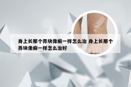 身上长那个弄块像癣一样怎么治 身上长那个弄块像癣一样怎么治好