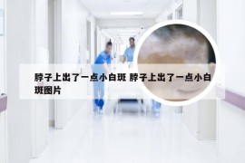 脖子上出了一点小白斑 脖子上出了一点小白斑图片