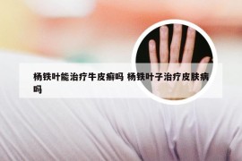 杨铁叶能治疗牛皮癣吗 杨铁叶子治疗皮肤病吗