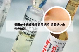德国uvb光疗能治银屑病吗 银屑病uvb光疗仪器