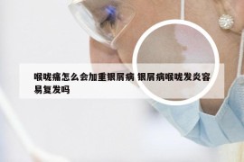 喉咙痛怎么会加重银屑病 银屑病喉咙发炎容易复发吗