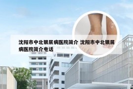 沈阳市中北银屑病医院简介 沈阳市中北银屑病医院简介电话
