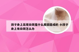 孩子身上出现白斑是什么原因造成的 小孩子身上有白斑怎么办