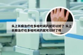 头上长癣治疗吃多啥时间药就可以好了 头上长癣治疗吃多啥时间药就可以好了呀