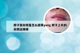 脖子张白斑是怎么回事yang 脖子上长的白斑还痒痒