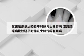 掌跖脓疱病比较轻平时抹凡士林行吗 掌跖脓疱病比较轻平时抹凡士林行吗有用吗
