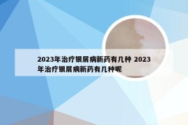 2023年治疗银屑病新药有几种 2023年治疗银屑病新药有几种呢