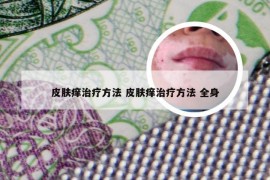 皮肤痒治疗方法 皮肤痒治疗方法 全身