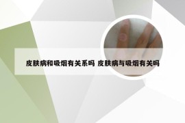 皮肤病和吸烟有关系吗 皮肤病与吸烟有关吗