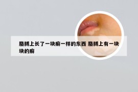 胳膊上长了一块癣一样的东西 胳膊上有一块块的癣