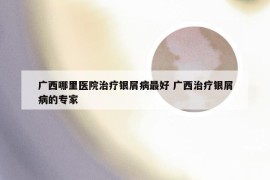 广西哪里医院治疗银屑病最好 广西治疗银屑病的专家