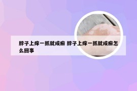脖子上痒一抓就成癣 脖子上痒一抓就成癣怎么回事