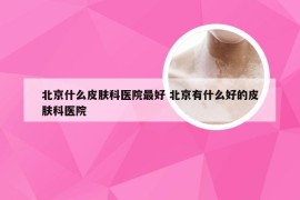 北京什么皮肤科医院最好 北京有什么好的皮肤科医院