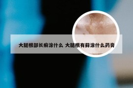 大腿根部长癣涂什么 大腿根有藓涂什么药膏