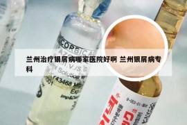 兰州治疗银屑病哪家医院好啊 兰州银屑病专科