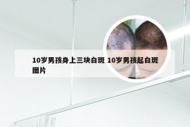 10岁男孩身上三块白斑 10岁男孩起白斑图片