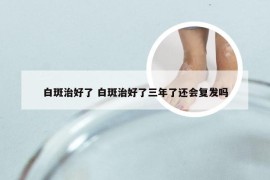 白斑治好了 白斑治好了三年了还会复发吗