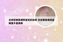 点状型银屑病恢复完的白斑 点状银屑病消退期是不是很痒