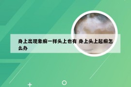身上出现象癣一样头上也有 身上头上起癣怎么办