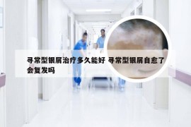 寻常型银屑治疗多久能好 寻常型银屑自愈了会复发吗