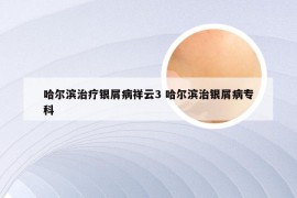 哈尔滨治疗银屑病祥云3 哈尔滨治银屑病专科