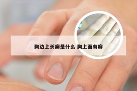 胸边上长癣是什么 胸上面有癣