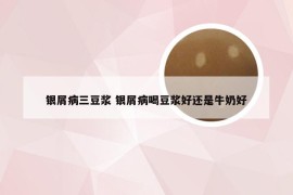 银屑病三豆浆 银屑病喝豆浆好还是牛奶好