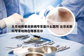北京哈刚看皮肤病专家是什么医院 北京皮肤科专家哈刚在哪里出诊