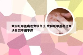 大脚趾甲盖出现大块白斑 大脚趾甲盖出现大块白斑不痛不痒