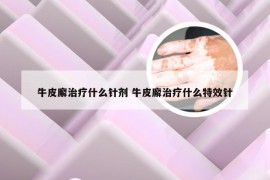 牛皮廨治疗什么针剂 牛皮廨治疗什么特效针