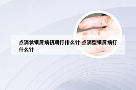 点滴状银屑病初期打什么针 点滴型银屑病打什么针