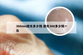 308nm激光多少钱 激光308多少钱一台