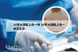 10岁小孩脸上白一块 10岁小孩脸上白一块怎么办