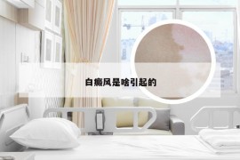 白癜风是啥引起的