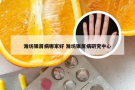 潍坊银屑病哪家好 潍坊银屑病研究中心
