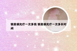 银屑病光疗一次多钱 银屑病光疗一次多长时间