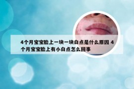 4个月宝宝脸上一块一块白点是什么原因 4个月宝宝脸上有小白点怎么回事