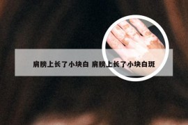 肩膀上长了小块白 肩膀上长了小块白斑