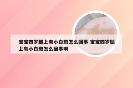 宝宝四岁腿上有小白斑怎么回事 宝宝四岁腿上有小白斑怎么回事啊
