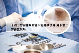 卡泊三醇副作用后能不能继续使用 用卡泊三醇会复发吗