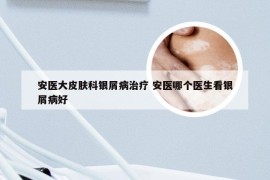 安医大皮肤科银屑病治疗 安医哪个医生看银屑病好