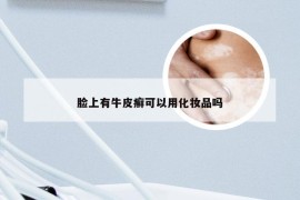 脸上有牛皮癣可以用化妆品吗