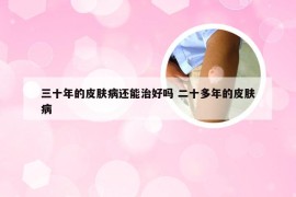 三十年的皮肤病还能治好吗 二十多年的皮肤病