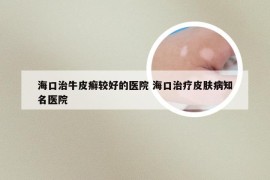 海口治牛皮癣较好的医院 海口治疗皮肤病知名医院