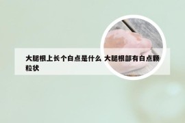 大腿根上长个白点是什么 大腿根部有白点颗粒状
