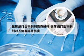 银屑病打生物制剂类克好吗 银屑病打生物制剂对人体有哪些伤害